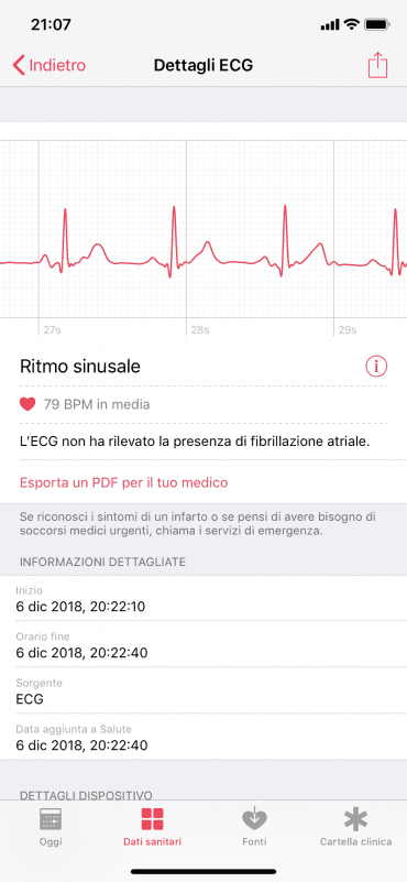 ECG in italiano su Apple Watch